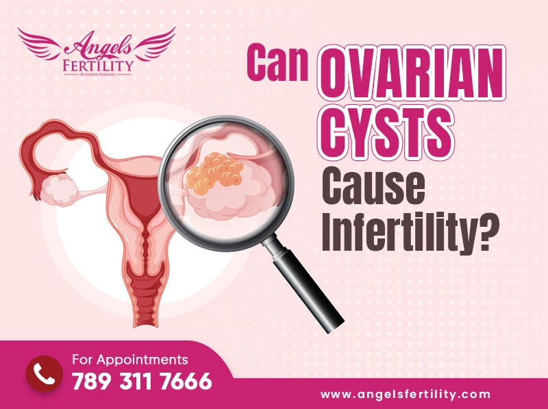 Can Ovarian Cysts Cause Infertility?